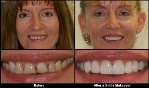 free teeth makeover